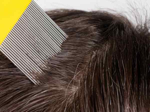 Durée de vie d’un poux et d’une lente sur un oreiller : Ce qu’il faut savoir pour lutter efficacement