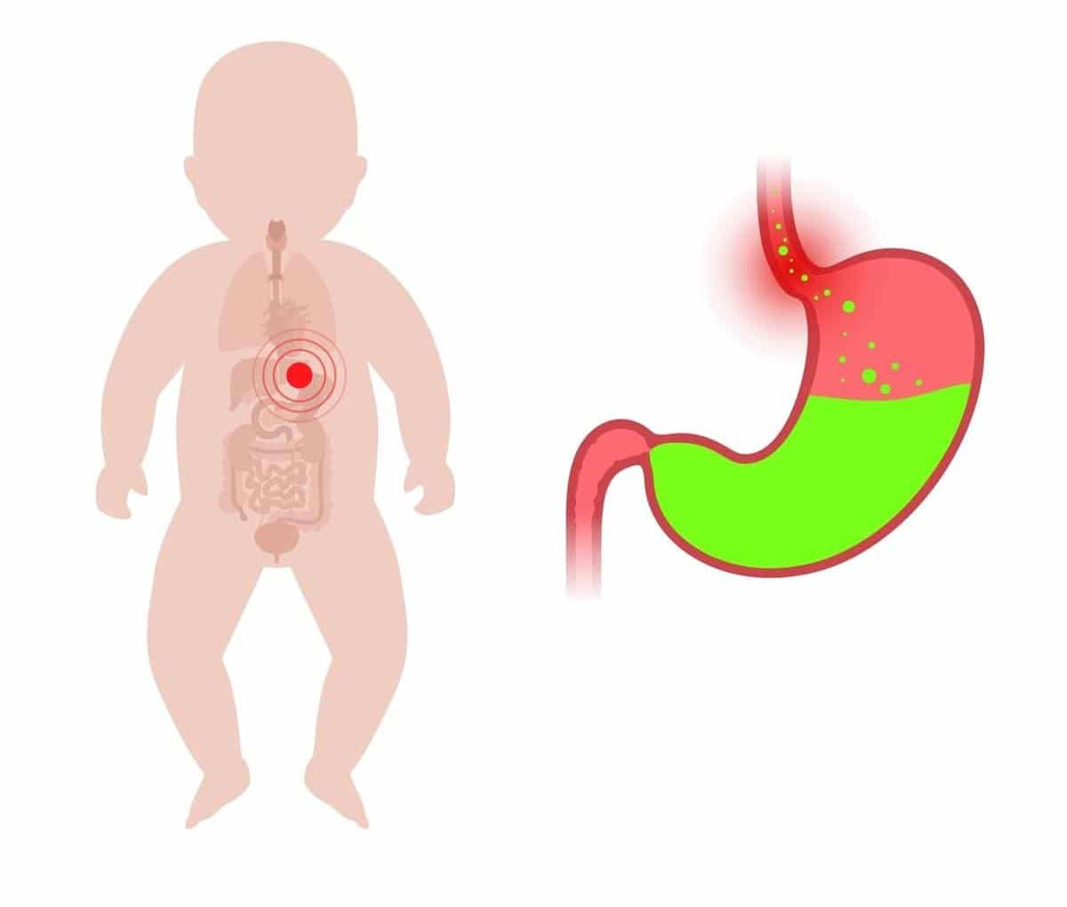Bébé RGO, comment aider votre bébé à dormir ?
